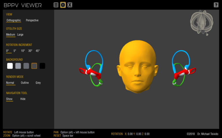 BPPV Viewer – BPPV Visualization with a 3D Model for Study and Teaching ...