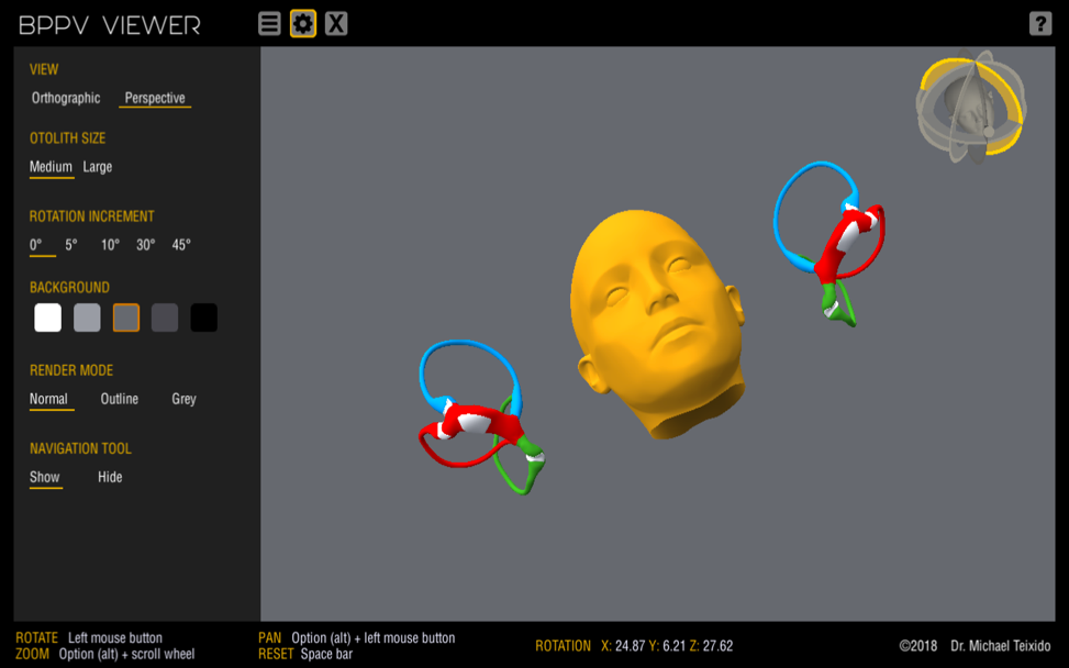 Bppv Program BPPV Viewer – BPPV Visualization with a 3D Model for Study and Teaching ...